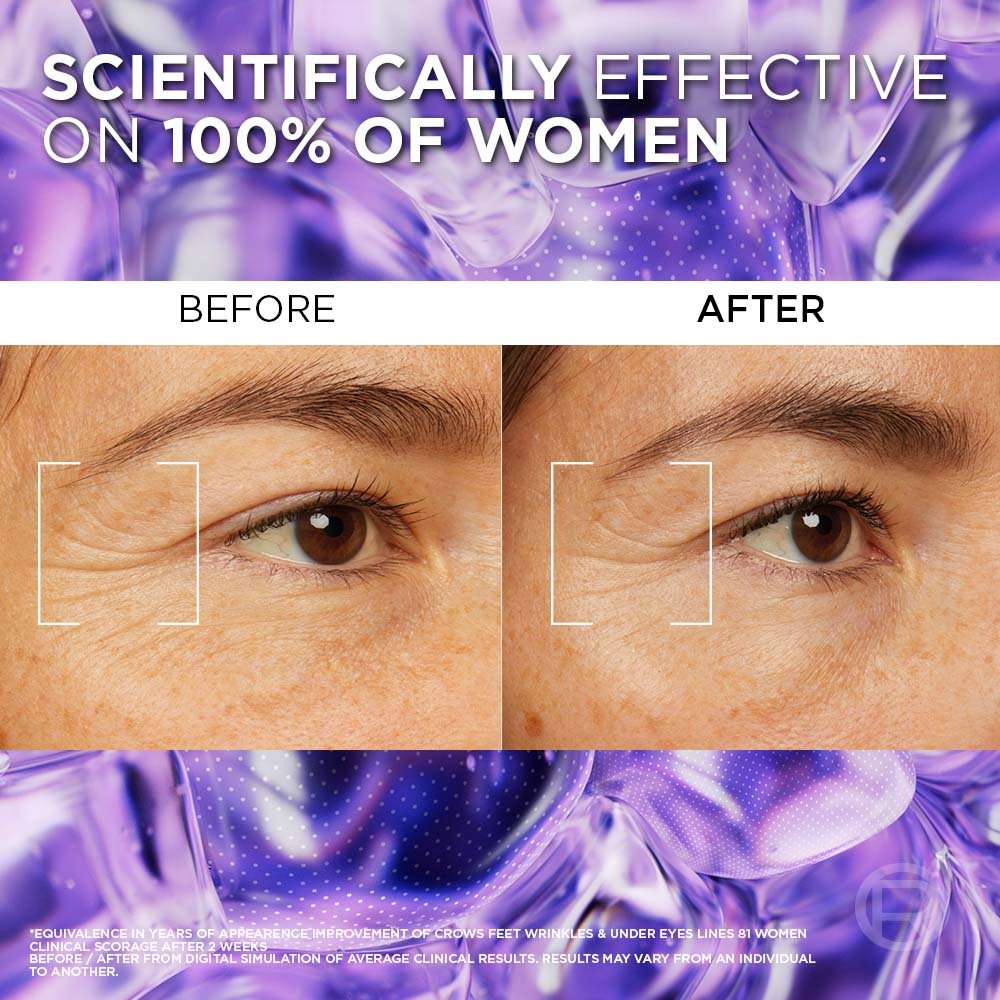 before and after filler dark circle serum